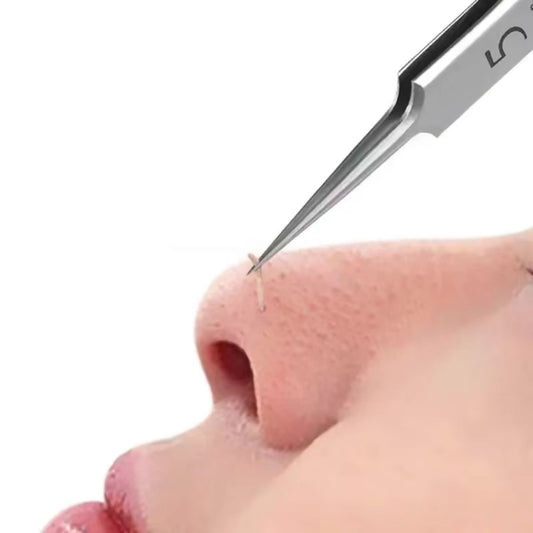 Professional Precision Blackhead Removal Tweezers